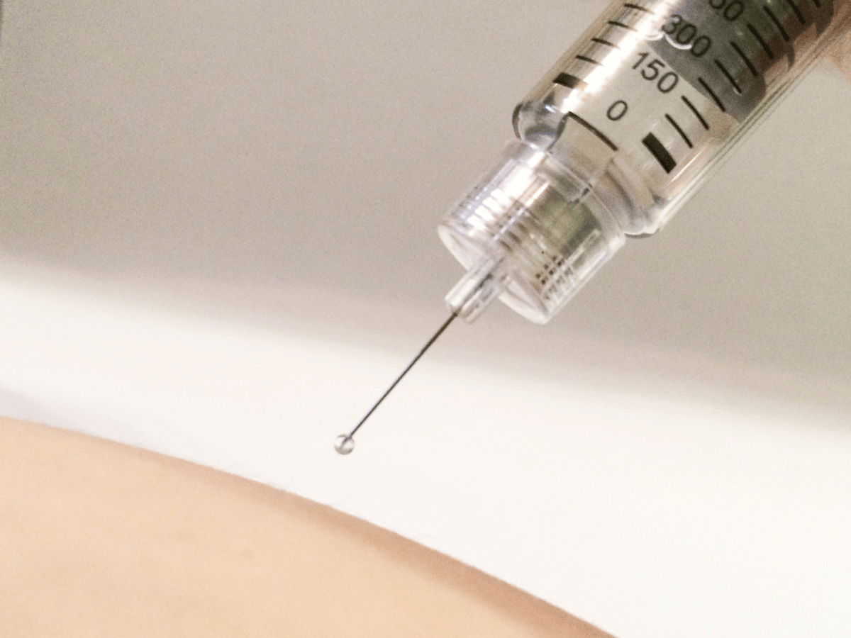 Dermal filler injection needle hovering above someone's skin.