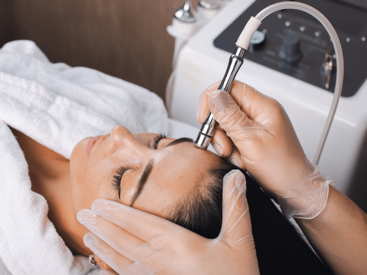 microdermabrasion treatment