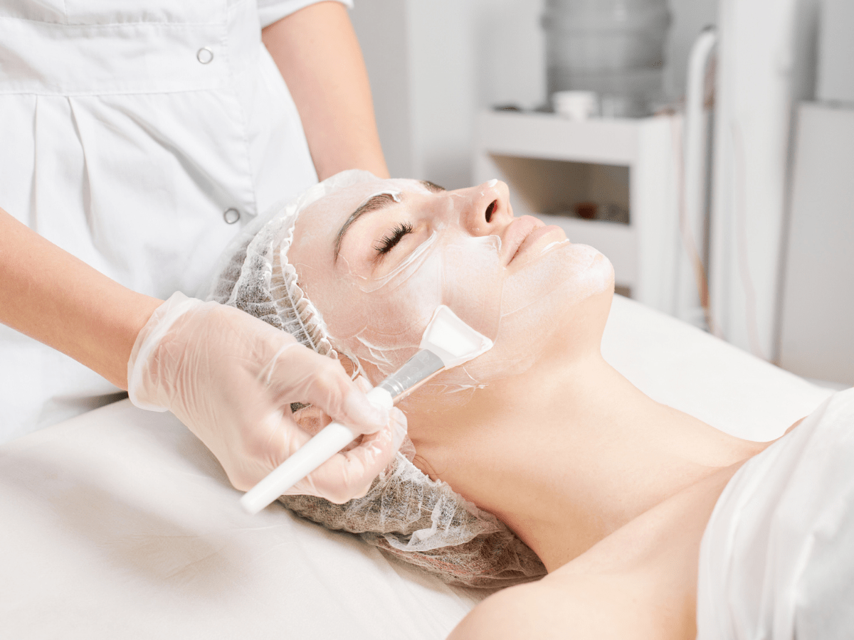 chemical peel treatment
